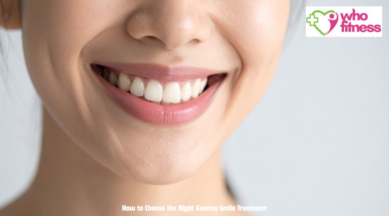How to Choose the Right Gummy Smile Treatment